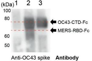 Purified protein identities were further confirmed by Western blot analysis using an anti‐OC43 spike antibody. (hCoV-OC43 Spike anticorps  (AA 15-344))