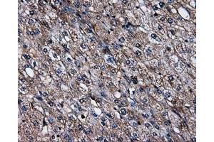 Immunohistochemical staining of paraffin-embedded liver tissue using anti-SATB1mouse monoclonal antibody. (SATB1 anticorps)