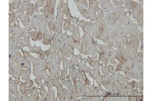 anti-Sarcoglycan, beta (43kDa Dystrophin-Associated Glycoprotein) (SGCB) (AA 87-196) antibody