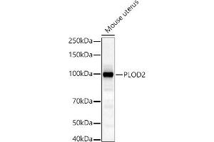 Western blot analysis of extracts of Mouse uterus, using PLOD2/LH2 antibody (ABIN6132888, ABIN6145788, ABIN6145790 and ABIN6222693) at 1:1000 dilution. (PLOD2 anticorps  (AA 470-650))