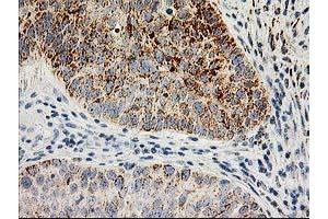 Image no. 3 for anti-Adenylate Kinase 4 (AK4) antibody (ABIN1496525)