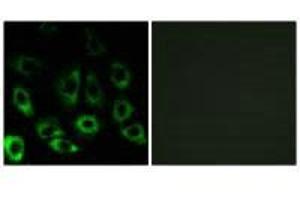 Immunofluorescence analysis of A549 cells, using MBTPS2 antibody. (MBTPS2 anticorps)