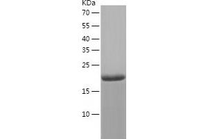 Western Blotting (WB) image for Charged Multivesicular Body Protein 6 (CHMP6) (AA 1-201) protein (His tag) (ABIN7122256)
