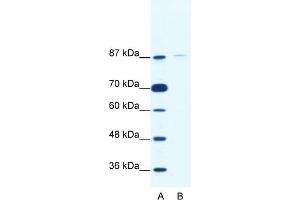 WB Suggested Anti-TAF1C Antibody Titration:  2. (TAF1C anticorps  (C-Term))
