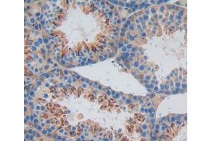 IHC-P analysis of Kidney tissue, with DAB staining. (RIPK2 anticorps  (AA 1-294))
