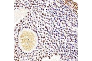 Wee2 antibody immunohistochemistry analysis in formalin fixed and paraffin embedded mouse ovarian tissue.