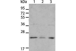 Western Blot analysis of A431 and A172 cell, Human liver cancer tissue using BNIP1 Polyclonal Antibody at dilution of 1:550 (BNIP1 anticorps)