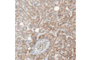 Immunohistochemical staining (Formalin-fixed paraffin-embedded sections) of human liver with SDHB monoclonal antibody, clone CL0346  shows moderate cytoplasmic positivity in the hepatocytes. (SDHB anticorps)