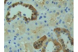DAB staining on IHC-P; Samples: Human Kidney Tissue (RYK anticorps  (AA 308-570))