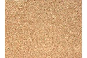 CASPR Immunohistochemistry.