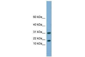 EIF5A2 antibody used at 1 ug/ml to detect target protein. (EIF5A2 anticorps  (N-Term))