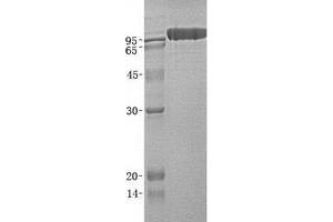 Validation with Western Blot