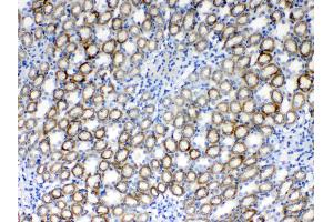 IHC analysis of RPS6 using anti- RPS6 antibody .