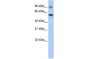 ASCC2 antibody used at 1 ug/ml to detect target protein. (ASCC2 anticorps  (Middle Region))