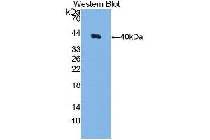 Detection of Recombinant F1+2, Rat using Polyclonal Antibody to Prothrombin Fragment 1+2 (F1+2)