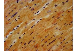 IHC image of ABIN7153521 diluted at 1:1200 and staining in paraffin-embedded human heart tissue performed on a Leica BondTM system.