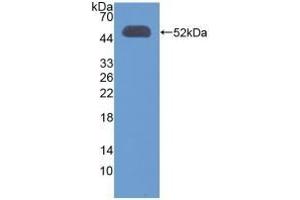Detection of Recombinant OXCT1, Human using Polyclonal Antibody to 3-Oxoacid Coenzyme A Transferase 1 (OXCT1) (OXCT1 anticorps  (AA 40-489))