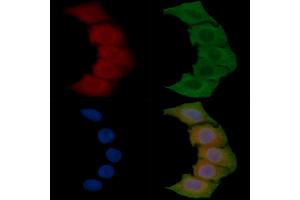 ABIN6257413 and ABIN6275351 staining Hela cells(45 min of heat-shock) by IF/ICC.