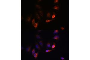 Immunofluorescence analysis of U-251MG cells using B antibody (ABIN6129977, ABIN6137413, ABIN6137415 and ABIN6220894) at dilution of 1:100. (BACE1 anticorps  (AA 22-322))