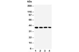 Western blot testing of MTCO1 antibody and Lane 1:  SMMC-7721;  2: MCF-7;  3: Raji;  4: SW620 cell lysate (COX1 anticorps  (C-Term))