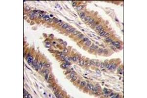 Image no. 2 for anti-Protein Kinase, X-Linked (PRKX) (C-Term) antibody (ABIN360336) (PRKX anticorps  (C-Term))