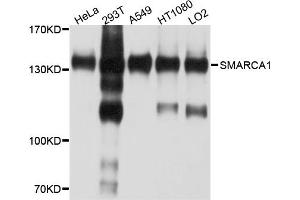 Western blot analysis of extracts of various cell lines, using SMARCA1 antibody. (SMARCA1 anticorps)