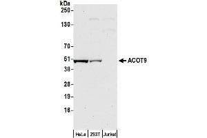 Western Blotting (WB) image for anti-Acyl-CoA Thioesterase 9 (Acot9) (AA 200-250) antibody (ABIN7452800)