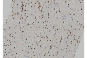 ABIN6267172 at 1/100 staining Mouse heart tissue by IHC-P. (RPS6KA3 anticorps  (pSer227))