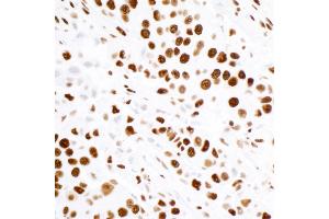 Immunohistochemistry (IHC) image for anti-Tripartite Motif Containing 28 (TRIM28) (Ser824) antibody (ABIN7454012) (Recombinant KAP1 anticorps  (Ser824))