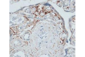 Immunohistochemistry of paraffin-embedded Human placenta using SLAMF7 Polyclonal Antibody at dilution of 1:100 (40x lens). (SLAMF7 anticorps)