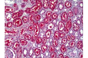 Anti-ATP6V1B2 antibody IHC of human kidney, tubules.