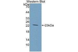 Western Blotting (WB) image for anti-Glucokinase (Hexokinase 4) Regulator (GCKR) (AA 90-286) antibody (ABIN3201594) (GCKR anticorps  (AA 90-286))