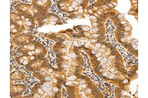 ABIN6259742 and ABIN6272985 at 1/100 staining Rat colon tissue by IHC-P. (ACSL4 anticorps  (N-Term))