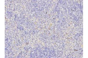 Immunohistochemistry (IHC) image for anti-TNF Receptor Superfamily, Member 6 (FAS) (AA 150-250) antibody (ABIN3020739) (FAS anticorps  (AA 150-250))