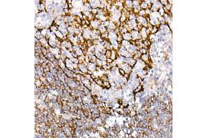 Immunohistochemistry of paraffin-embedded Human tonsil using CD35/CR1 antibody (ABIN7266477) at dilution of 50 (40x lens). (CD35 anticorps)