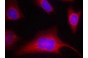 Immunofluorescence staining of methanol-fixed Hela cells using PKD/PKCm(Phospho-Ser910) Antibody.