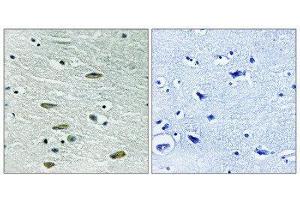 Immunohistochemistry (IHC) image for anti-Insulin-Like Growth Factor 1 Receptor (IGF1R) (Tyr1346) antibody (ABIN1848190)