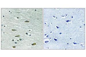 Immunohistochemistry (IHC) image for anti-Insulin-Like Growth Factor 1 Receptor (IGF1R) (Tyr1346) antibody (ABIN1848190) (IGF1R anticorps  (Tyr1346))