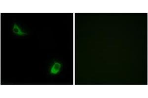 Immunofluorescence analysis of LOVO cells, using FPRL2 Antibody. (FPR3 anticorps  (AA 304-353))