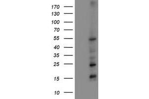 Western Blotting (WB) image for anti-Myocyte Enhancer Factor 2C (MEF2C) antibody (ABIN1499366)