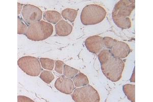 Used in DAB staining on fromalin fixed paraffin- embedded skeletal muscle tissue (Triadin anticorps  (AA 486-687))