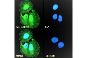 (ABIN238631) Immunofluorescence analysis of paraformaldehyde fixed U2OS cells, permeabilized with 0.