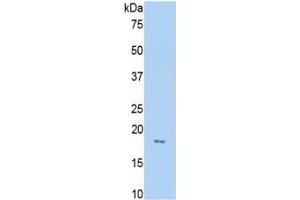 Rabbit Capture antibody from the kit in WB with Positive Control:  Lane1: Rat Liver lysate; Lane2: Rat Lung lysate; Lane3: Rat Placenta lysate; Lane4: Rat Serum.