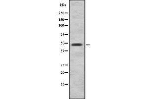 Western blot analysis of PABPN1 using A549 whole  lysates. (PABPN1 anticorps  (C-Term))