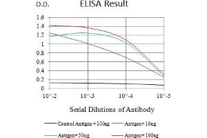 Black line: Control Antigen (100 ng),Purple line: Antigen (10 ng), Blue line: Antigen (50 ng), Red line:Antigen (100 ng)