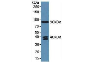 Western blot analysis of Human Serum. (C4A anticorps  (AA 680-756))