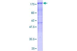 Image no. 1 for Histone Deacetylase 6 (HDAC6) (AA 1-1063) protein (GST tag) (ABIN1306458)