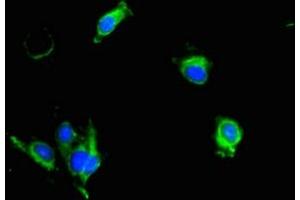 Immunofluorescent analysis of Hela cells using ABIN7157217 at dilution of 1:100 and Alexa Fluor 488-congugated AffiniPure Goat Anti-Rabbit IgG(H+L)