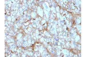 Formalin-fixed, paraffin-embedded human Kidney stained with C1QA Mouse Monoclonal Antibody (C1QA/2954). (C1QA anticorps  (AA 104-237))