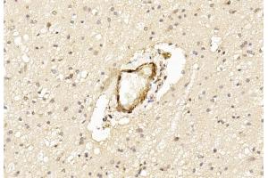 anti-Leucine Rich Repeat and Ig Domain Containing 1 (LINGO1) (AA 62-92), (N-Term) antibody